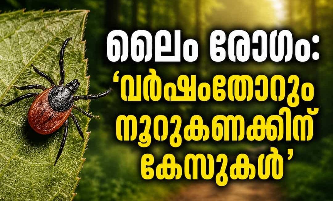 അയർലണ്ടിൽ പ്രതിവർഷം നൂറുകണക്കിന് ലൈം ഡിസീസ് (Lyme Disease) കേസുകൾ: മുന്നറിയിപ്പുമായി HSE